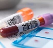 Laboratory diagnosis of prostatitis
