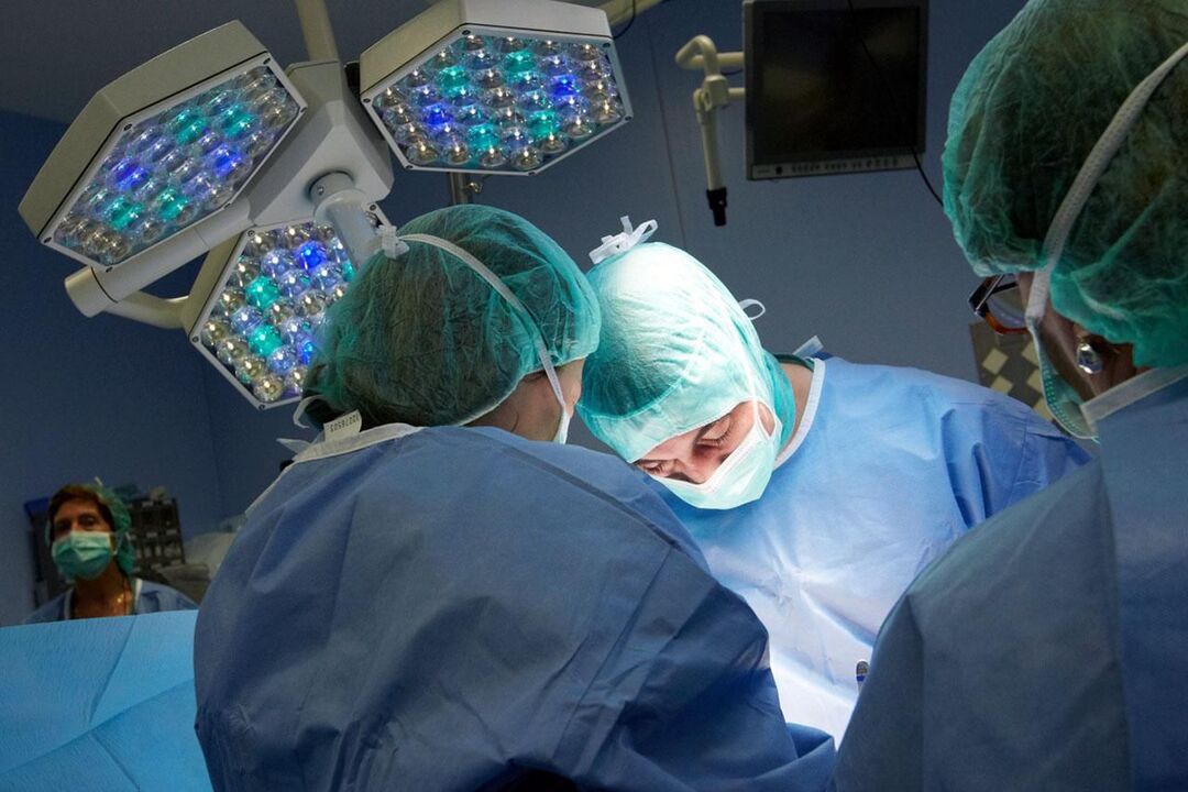 Surgery for chronic prostatitis