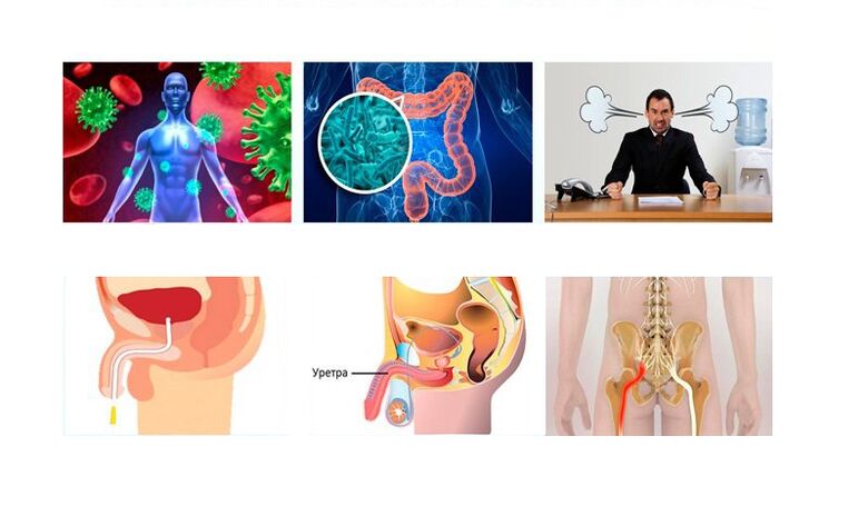 Causes of prostatitis