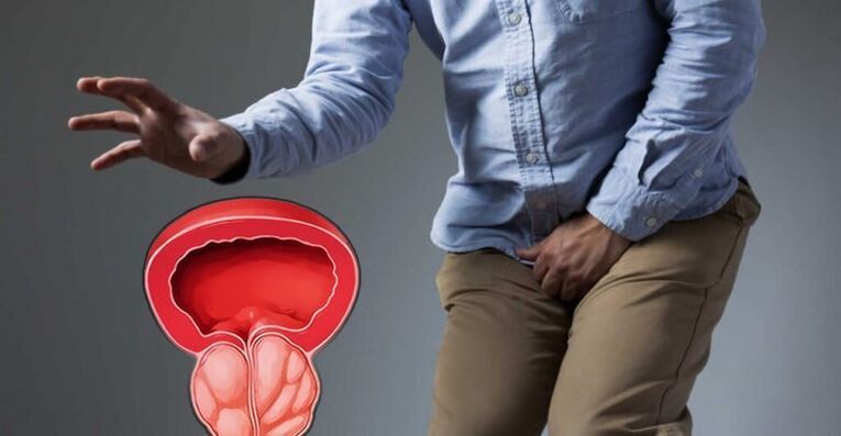 Symptoms of prostatitis in men