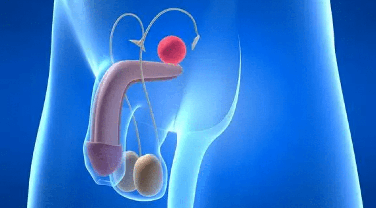 Prostatitis is an inflammation of the prostate gland in men, which requires complex treatment